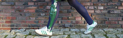 Individuelle angefertigte Orthesen nach Maß